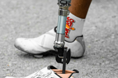 fund artificial limbs for children with amputations